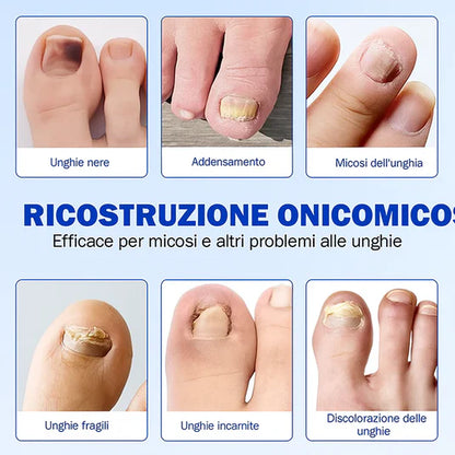 Patch Mediche Antifungine